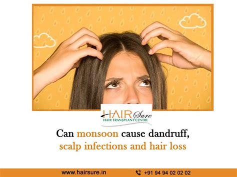 Can Monsoon Cause Dandruff Scalp Infections And Hair Loss Hair Sure