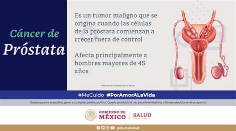 México cuenta con infraestructura para tratamiento de cáncer de