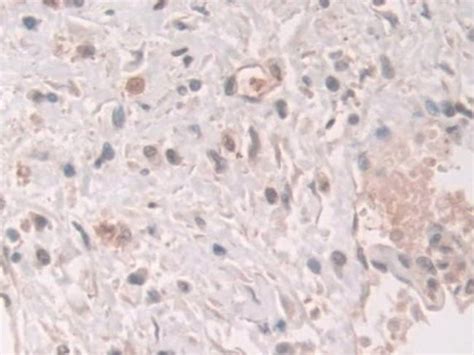 Grancalcin Polyclonal Antibody Invitrogen L Unconjugated