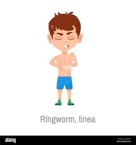 Child with ringworm tinea disease symptoms. Isolated vector sick boy ...