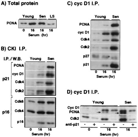 Increased Association Of P21 With Cyclin D1 Cdk4 6 Complexes In