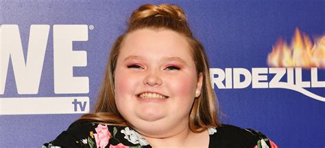 Alana ‘honey Boo Boo Thompson To Undergo Weight Loss Procedure Honey Boo Boo Newsies Just