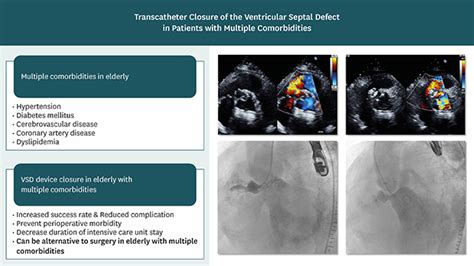 Cmsj Cardiometabolic Syndrome Journal