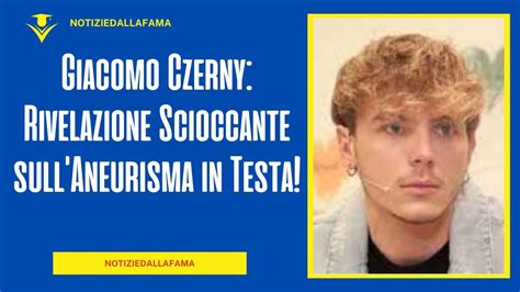 Giacomo Czerny Rivelazione Scioccante Sull Aneurisma In Testa Youtube