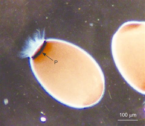 A Newly Released Parenchymella Larva Of Spongia Ceylonensis P