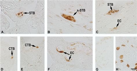 Typical Results Of Tunel Assay Showing Cell Apoptosis In Human