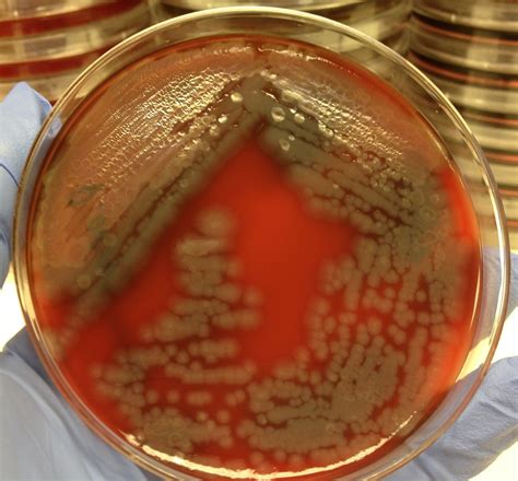 Morphology And Culture Characteristics Of Pseudomonas Aeruginosa Hot