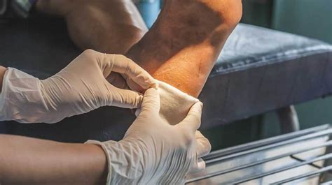 New Bandage May Help Wounds Heal More Quickly For People With Dia