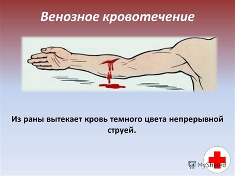 Презентация на тему: "Виды кровотечений, их признаки Первая помощь при ...