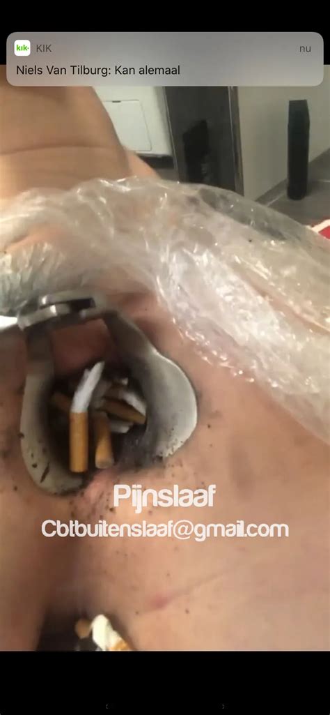 Fire Torture Nude Pics Xhamster