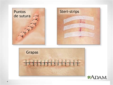 Tipos De Pontos De Sutura RETOEDU