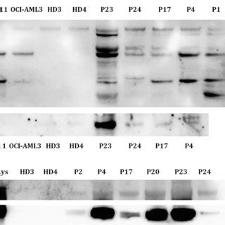 Western Blot Analysis Of EV Specific Markers A Western Blot Analysis