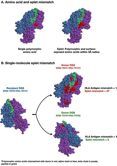 Frontiers HLA DR DQ Eplet Mismatch Predicts De Novo Donor Specific