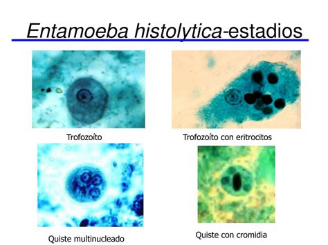 Ppt Generalidades De Protozoarios Y Amebas Powerpoint Presentation Free Download Id6446794