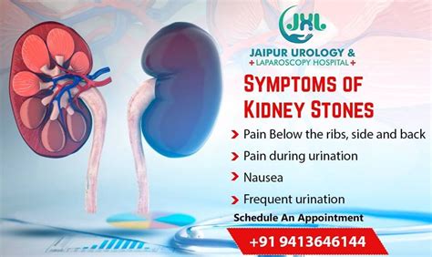 Major Procedures Adopted By Expert Urologists For Kidney Stone