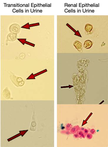 Urinalysis Body Fluids Exam Flashcards Quizlet