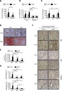 Dietary And Genetic Obesity Promote Liver Inflammation And Tumorigenesis By Enhancing Il 6 And