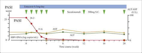 Jle European Journal Of Dermatology Psoriasis Vulgaris In A Hepatitis B Virus Carrier