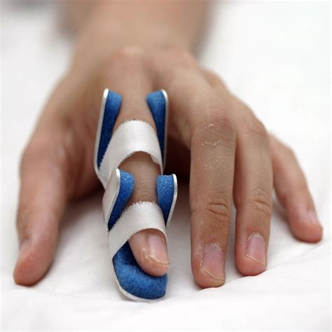 How Long Does It Take a Sprained Finger to Heal? - Within Normal Limits