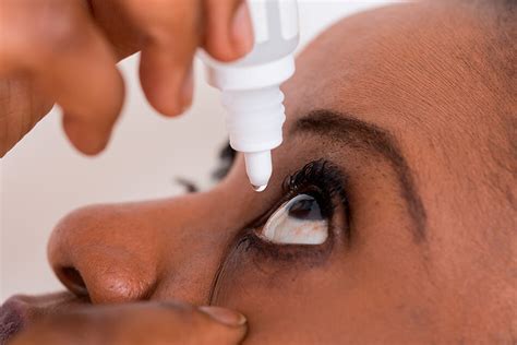 Contact Lens Rules People With Dry Eyes Should Always