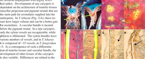 Details of caryopsis structure in T. kiharae (A, C, E, G, and H) and T ...