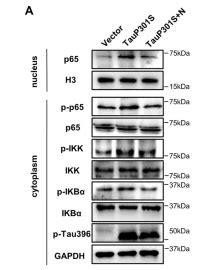 Phospho Ikb Alpha Ser Ser Antibody Affinity Biosciences Ltd