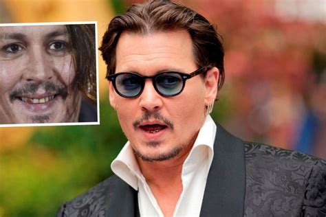 Does Johnny Depp Have A Rotten Teeth Johnny Depp Teeth Before And After