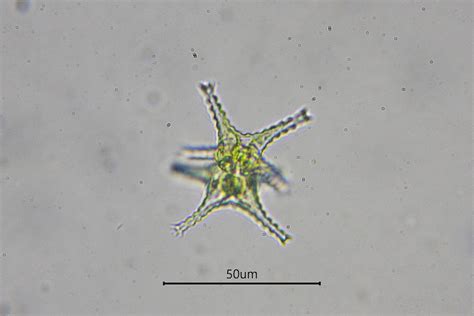 Staurastrum The Microscopic Life Of Shetland Lochs