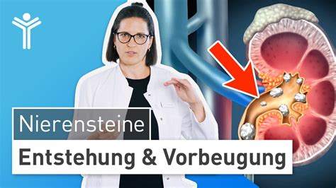 Nierensteine Entstehung Vorbeugung KLINIK Am RING