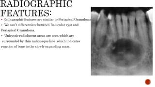 Radicular Cyst Or Periapical Odontogenic Cyst PPT