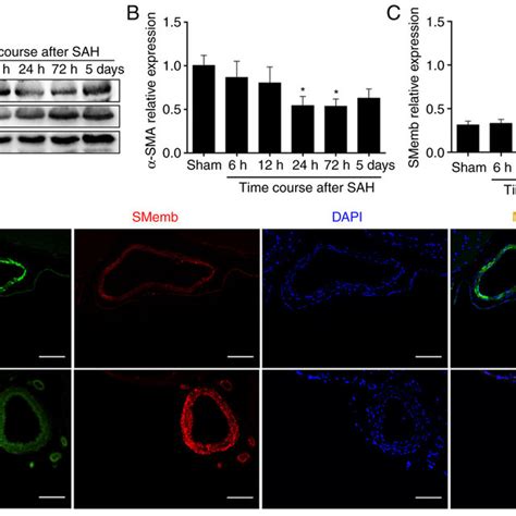 Expression Profile Of Sma And Smemb A Temporal Profile Of Sma