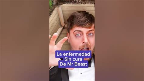 La Verdad Detrás De La Enfermedad Sin Cira De Mrbeast Sabiasque