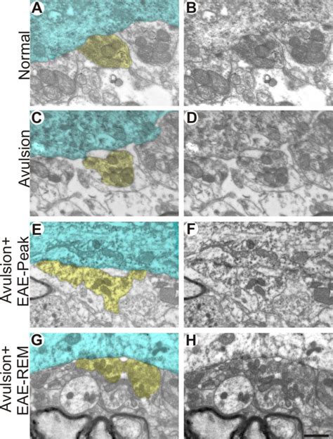 Ultrastructure of synapses apposed to alpha motoneurons. Normal input ...