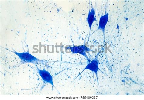 4,859 Brain Tissue Human Images, Stock Photos & Vectors | Shutterstock