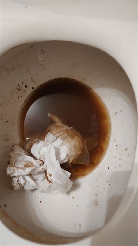 Burger King Poop Before Work 💩 Rratemypoo