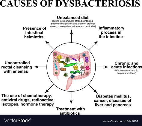 Causes dysbiosis colon bacteria pathogenic flora Vector Image