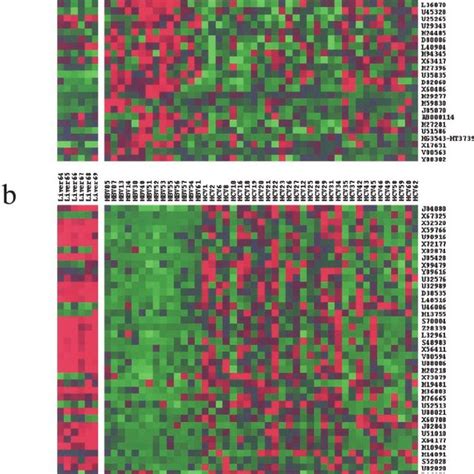 Gene Expression Profiles Linked To Hbv And Hcv Associated Hccs Color