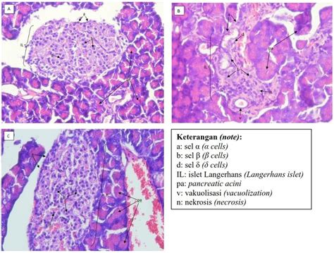 Gambar 1 Gambaran Histopatologi Pankreas Yang Diwarnai Dengan HE