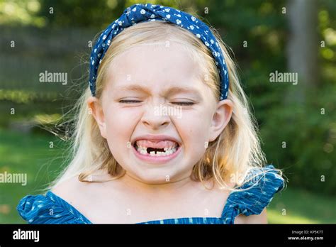 Two children missing teeth hi-res stock photography and images - Alamy