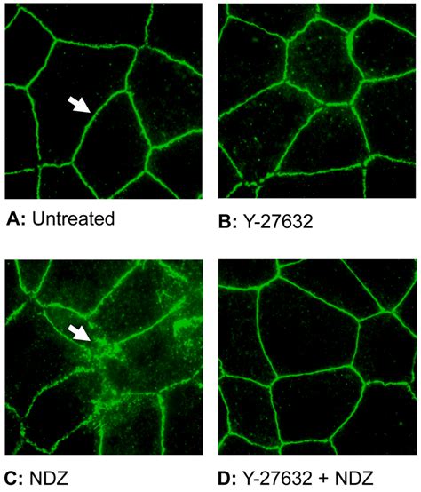 Effect Of Nocodazole On Localization Of Zo Immunostaining Of Zo In