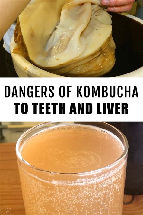 Kombucha Dangers And Side Effects Bad For Your Teeth And Liver With