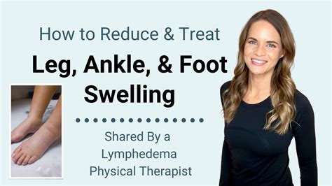 How To Treat Foot Ankle And Leg Lymphedema And Swelling From A