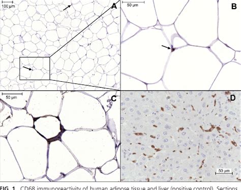 Figure 1 From Adipose Tissue Has Aberrant Morphology And Function In