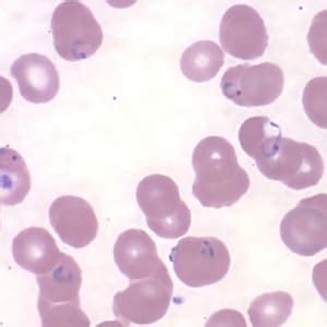 Plasmodium Falciparum Ring Stage Labeled