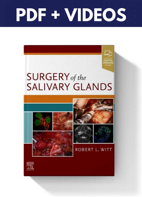 Surgery Of The Salivary Glands Pdf And Videos Dental Knowledge