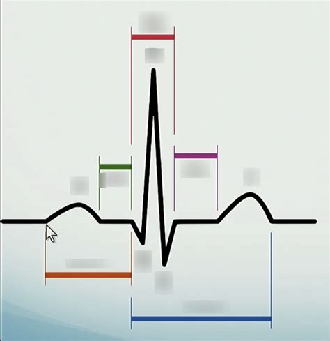 Label The Basic Ecg Waves And Intervals Diagram Quizlet