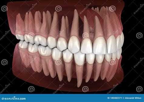 Morphology Of Mandibular And Maxillary Human Gum And Teeth Medically