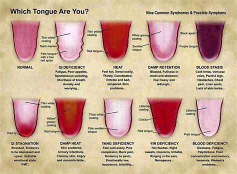 Brief Overview of Chinese Tongue and Pulse Diagnosis – Carolina Clinic ...