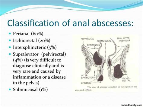 Anorectal Abscess Pictures