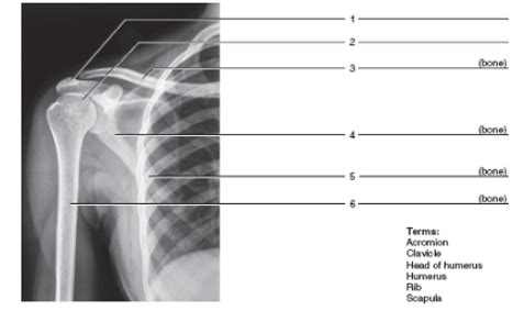 Solved Identify The Bones And Features Indicated Solutioninn